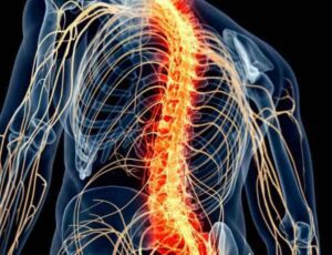 Nerve Disorders: RSD & CRPS